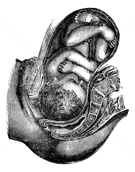 Engagement and descent of the head, vintage engraving. Stock photo © Morphart