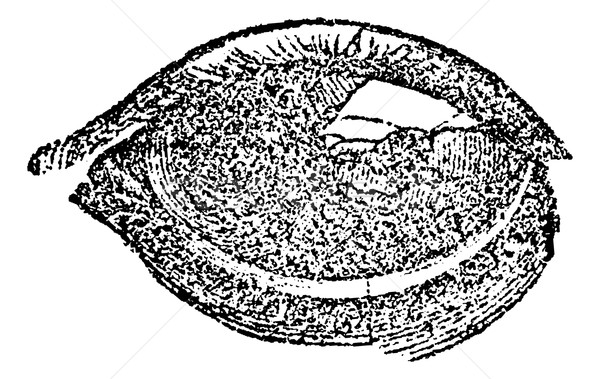 Eye with Vesicular or Pustular Keratitis, vintage engraving Stock photo © Morphart