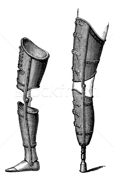 Artificial Legs, vintage engraving Stock photo © Morphart