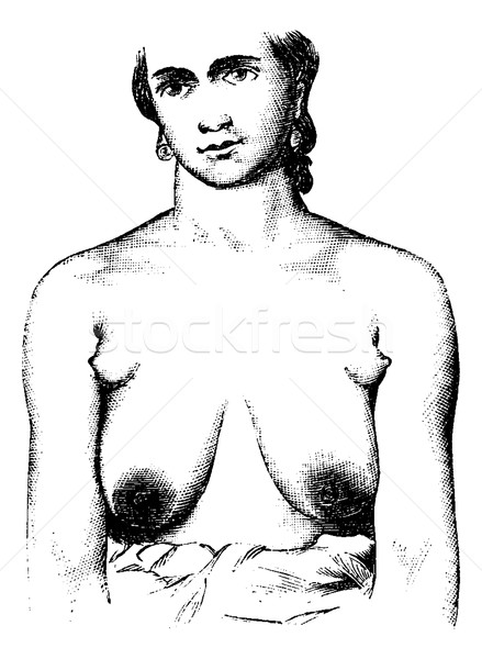 Extra teats placed in each axilla of breast, vintage engraving Stock photo © Morphart