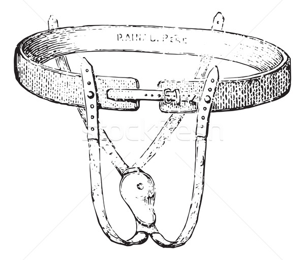 Device to contain the fall of rectum, vintage engraving. Stock photo © Morphart