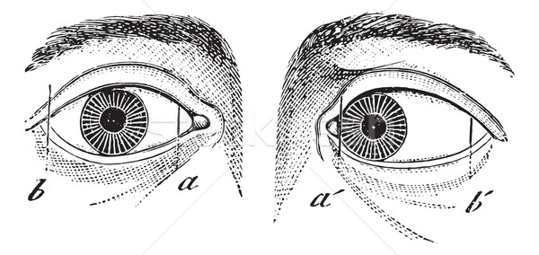 Esotropia of the left eye, vintage engraving. Stock photo © Morphart