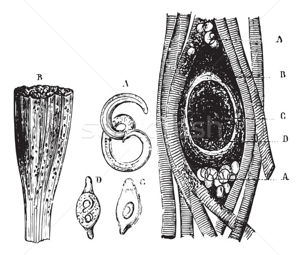 Fig.1210. A. Trichinella isolated. B. Portion of muscle attack w Stock photo © Morphart