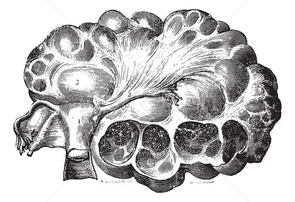 ストックフォト: 卵巣 · ヴィンテージ · 彫刻 · 刻ま · 実例 · 薬