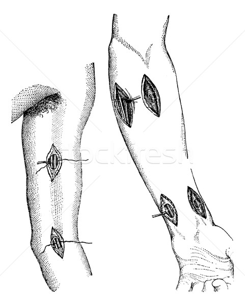 Fig. 760. - Showing the different points at which the arm can be Stock photo © Morphart