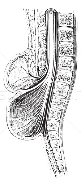 Cup anteroposterior spinal practiced on a spina bifida, vintage  Stock photo © Morphart