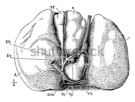 Operatie nagel vintage gegraveerd illustratie geneeskunde Stockfoto © Morphart
