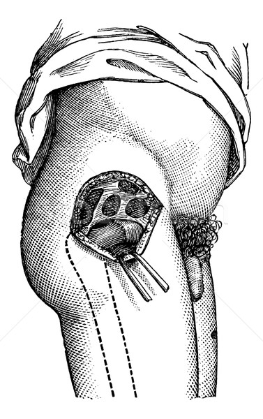 Hip joint opened by the outside, to show the neck of the femur,  Stock photo © Morphart