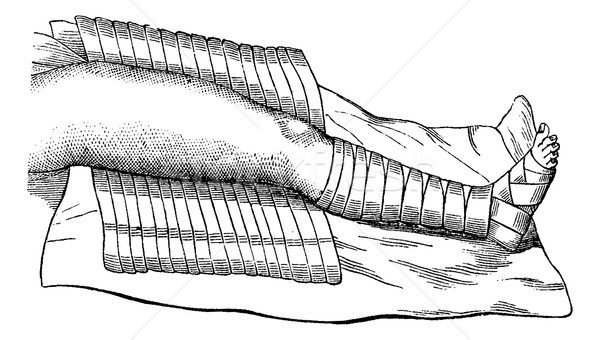 Bein teilweise Verband Jahrgang Gravur graviert Stock foto © Morphart