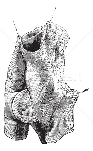 Foreign body in the esophagus, vintage engraving. Stock photo © Morphart