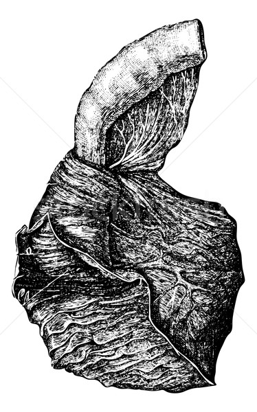 Intussusception of the Intestine, vintage engraving Stock photo © Morphart