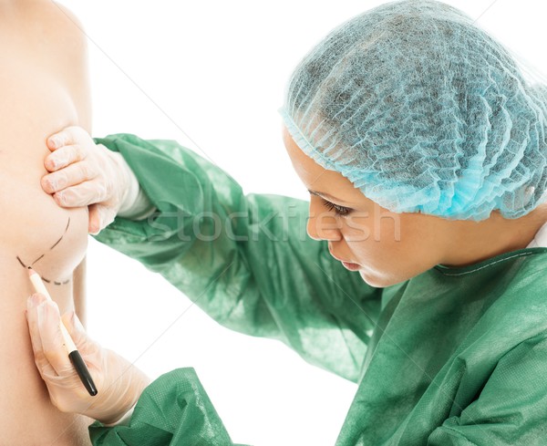 Plastic surgeon woman drawing on body lines for breast implant operation Stock photo © Nejron