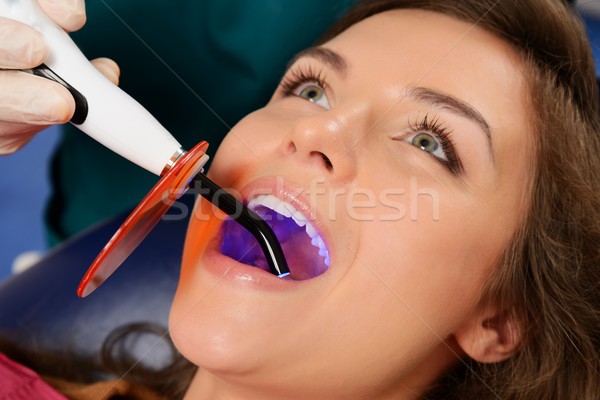 年輕女子 病人 治療 牙科 uv 商業照片 © Nejron