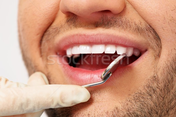 Man doing teeth checkup at dentist's surgery  Stock photo © Nejron