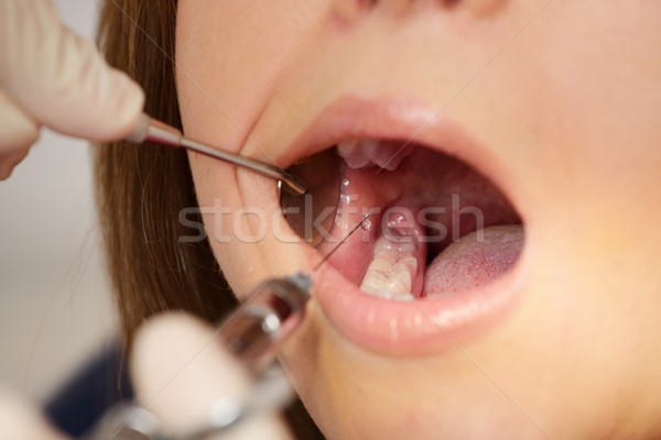 Dentist making anaesthetic injection to woman patient  Stock photo © Nejron