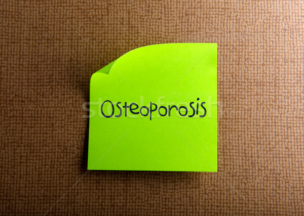 Osteoporoza afaceri birou model verde comunicare Imagine de stoc © nenovbrothers