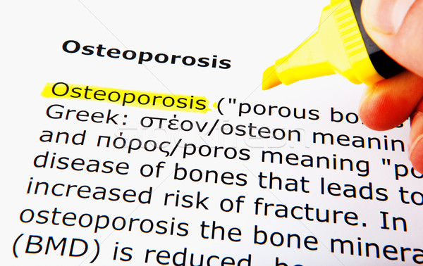 Osteoporose hand vrouwen medische ziekenhuis massage Stockfoto © nenovbrothers