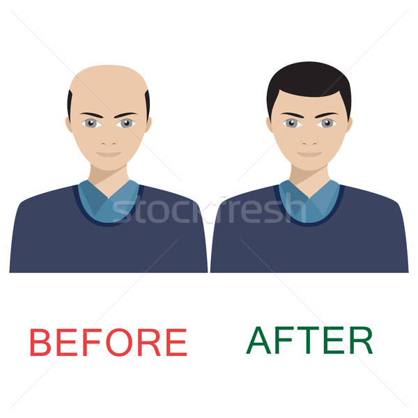 Man before and after hair treatment. Stock photo © Neokryuger