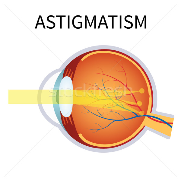 Problème floue vision illustration anatomie [[stock_photo]] © Neokryuger