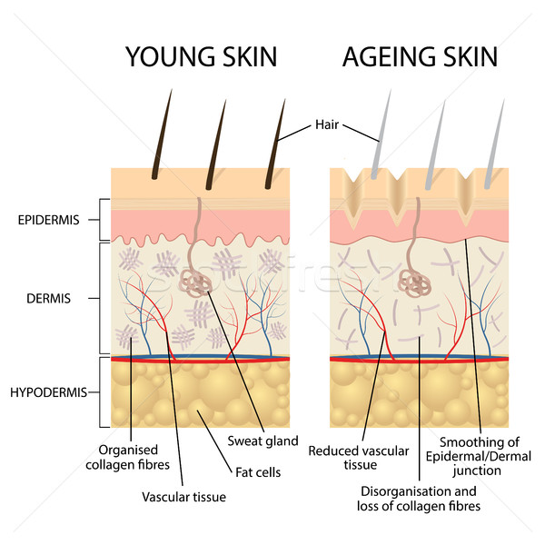 Młodych skóry zdrowych porównanie warstwy Zdjęcia stock © Neokryuger