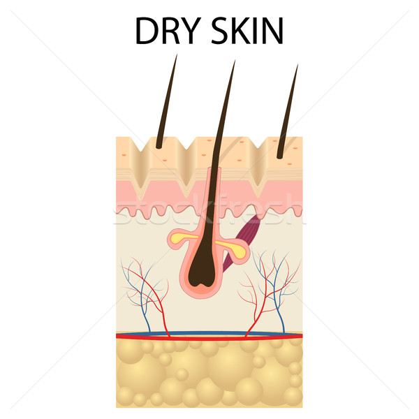 Illustration of The layers of dry skin Stock photo © Neokryuger