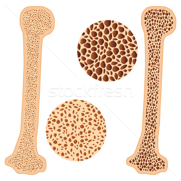 Osteoporoza kości zdrowych ilustracja biały medycznych Zdjęcia stock © Neokryuger