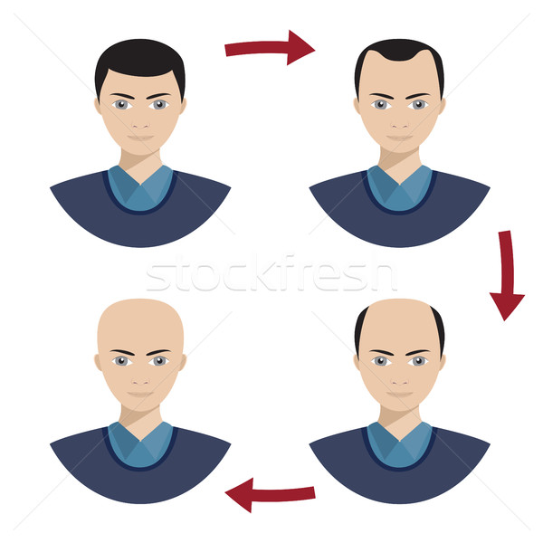 Four stages of hair loss for men. Stock photo © Neokryuger