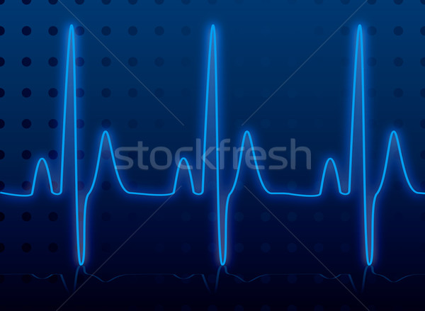 Battito del cuore bagliore medici monitor blu nero Foto d'archivio © nicemonkey