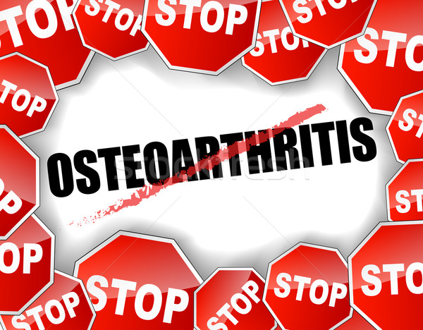 stop osteoarthritis Stock photo © nickylarson974