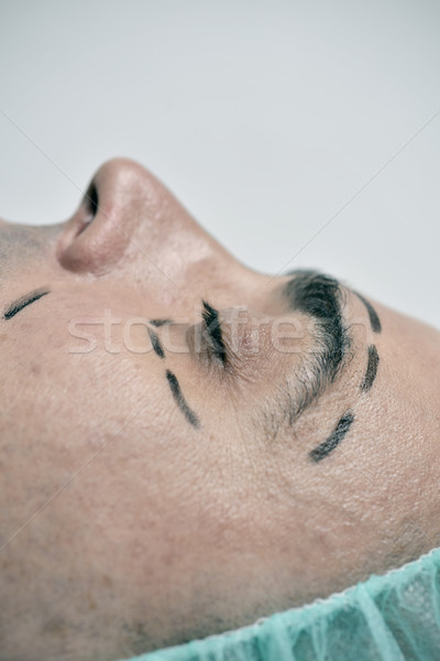 Férfi plasztikai sebészet közelkép fej fiatal kaukázusi Stock fotó © nito