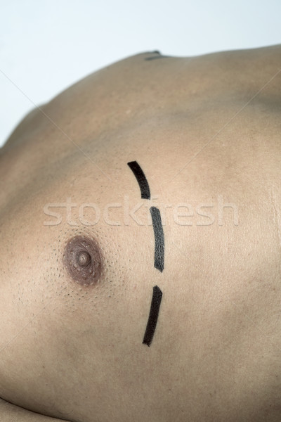Człowiek chirurgia plastyczna liposukcja piersi młodych Zdjęcia stock © nito