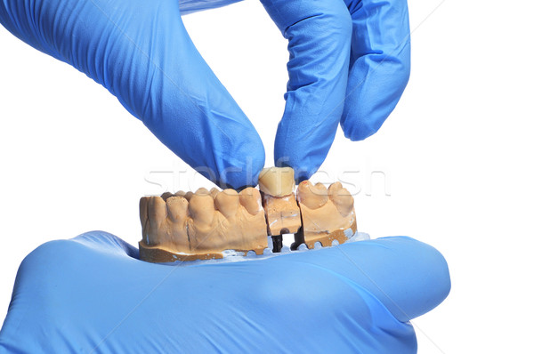 Tandarts iemand handschoenen tonen tandheelkundige Stockfoto © nito