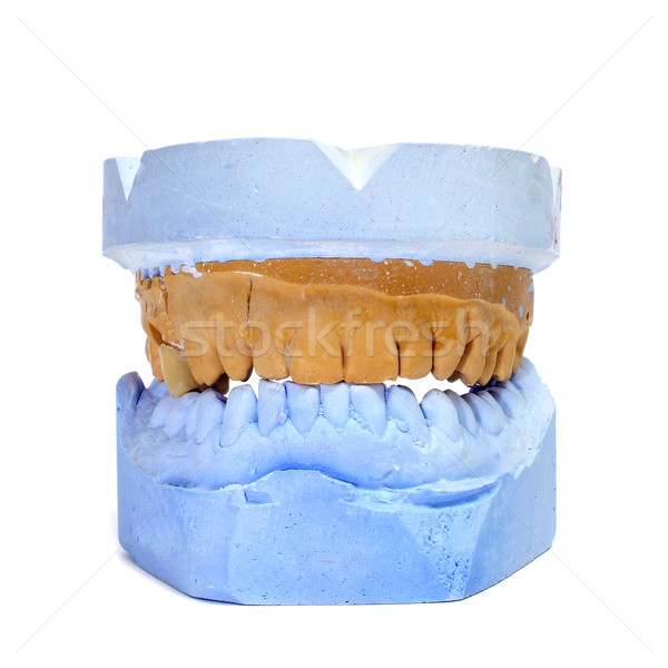 Dental muffa bianco blu bocca pietra Foto d'archivio © nito