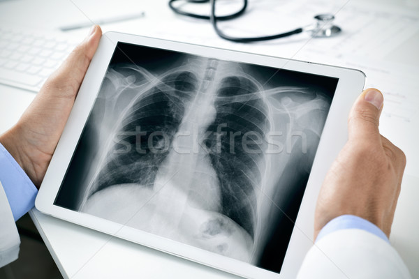 doctor observing a chest radiograph in a tablet Stock photo © nito
