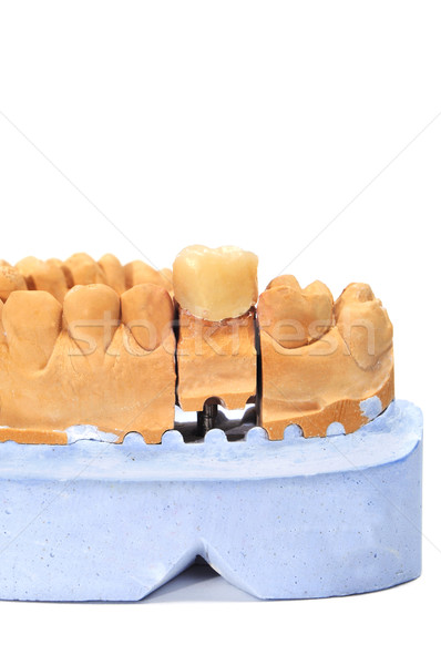 Diş protez beyaz mavi Stok fotoğraf © nito