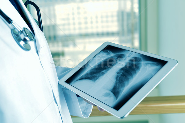 doctor observing a chest radiograph in a tablet Stock photo © nito