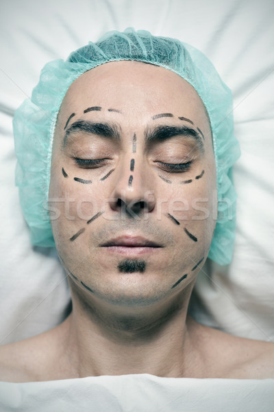 Homem cirurgia plástica tiro cabeça jovem caucasiano Foto stock © nito