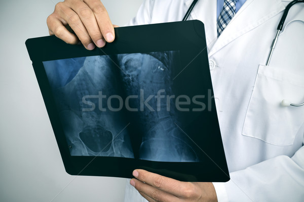Stock photo: doctor observing a skeleton radiograph