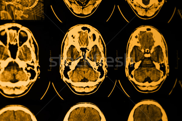 Сток-фото: МРТ · череп · фото · медицинской · фильма · технологий