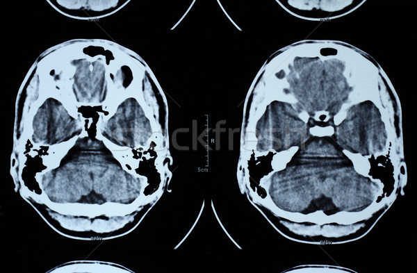 Mri cranio foto medici film tecnologia Foto d'archivio © Nneirda