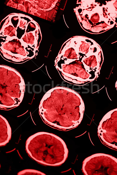 Mri schedel foto film technologie gezondheid Stockfoto © Nneirda