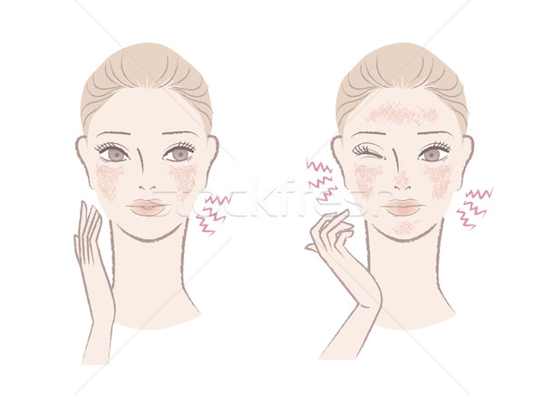 Beautiful woman annoyed with ruddy, sensitive skin Stock photo © norwayblue