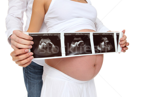 Pár gyermek röntgen fiatal terhes tart Stock fotó © nruboc