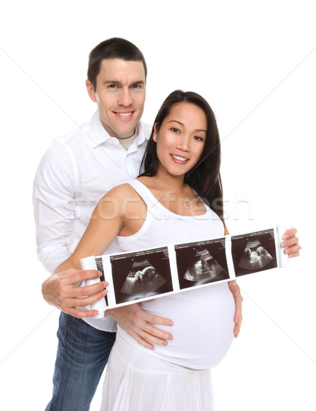 Couple Expecting Child with X-Ray Stock photo © nruboc