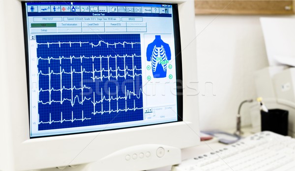 Kardiologie Büro Schreibtisch Kardiologe Diagramm Stock foto © nyul