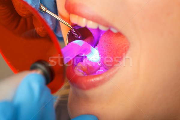 Dentaires dentiste travail lampe orale cavité [[stock_photo]] © ocskaymark