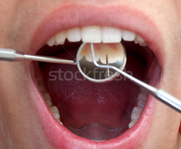 Dentaires main visage bouche [[stock_photo]] © ocskaymark