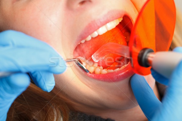 Dental obturation Stock photo © ocskaymark