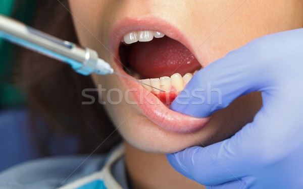 Diş anestezi resim el tıbbi çalışma Stok fotoğraf © ocskaymark