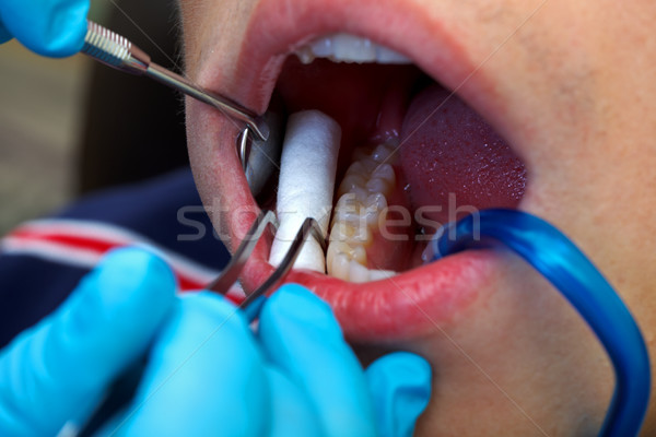 Dental check up Stock photo © ocskaymark